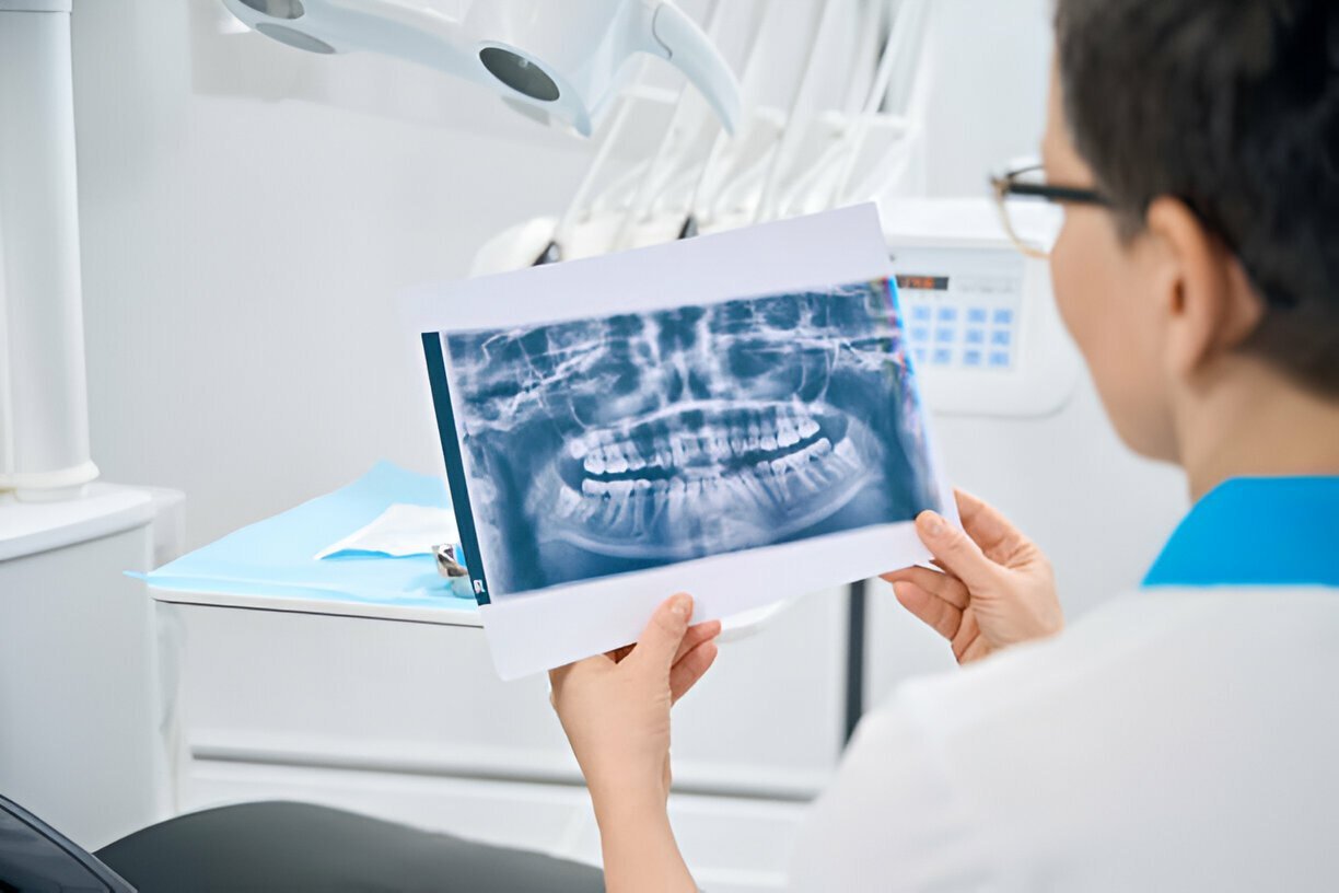 periodontists pārbauda pacienta žokļa rentgena attēlu