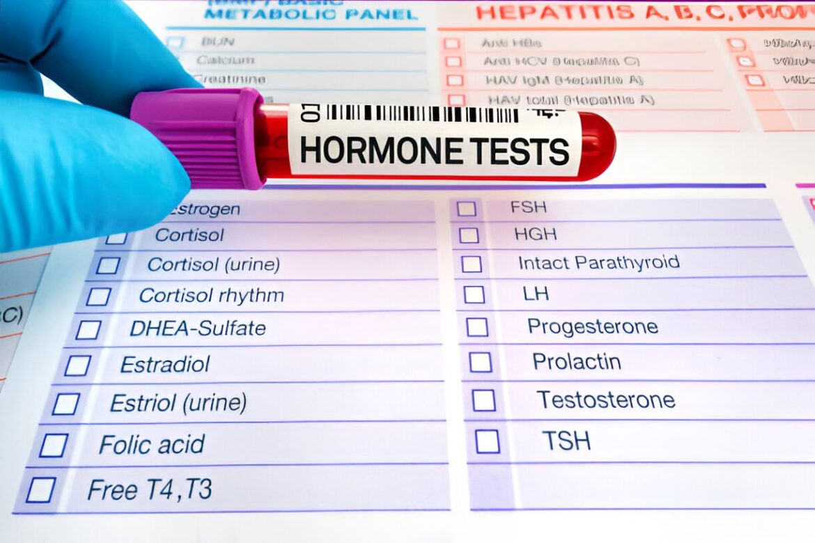 Folikulus stimulējošais hormons (FSH)